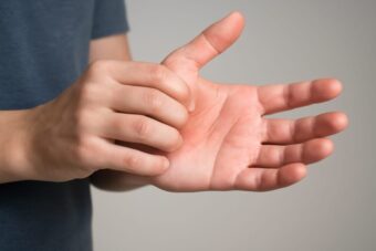 Warum juckt die rechte Hand? Bedeutung und Aberglaube
