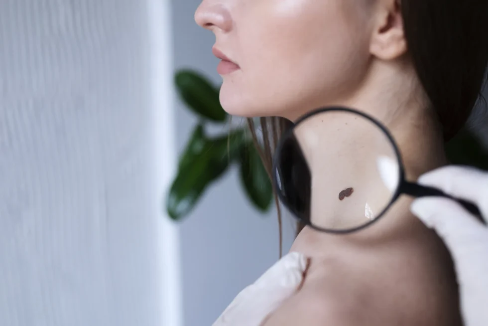 Ästhetische Medizin in der Schweiz: In Zürich bieten Fachkliniken moderne Laserbehandlungen, PRP-Therapie und Hautpflege zur Entfernung von Pigmentflecken und Alterswarzen.