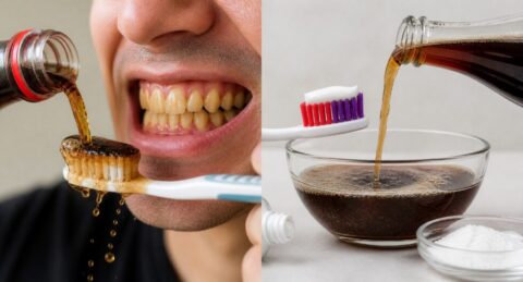 Wie wirkt Cola auf Zähne? Erfahren Sie alles über Zahnschmelz-Erosion, die Reinigung mit Coca-Cola und warum die Mischung aus Zahnpasta und Natron gefährlich für Ihre Mundgesundheit sein kann